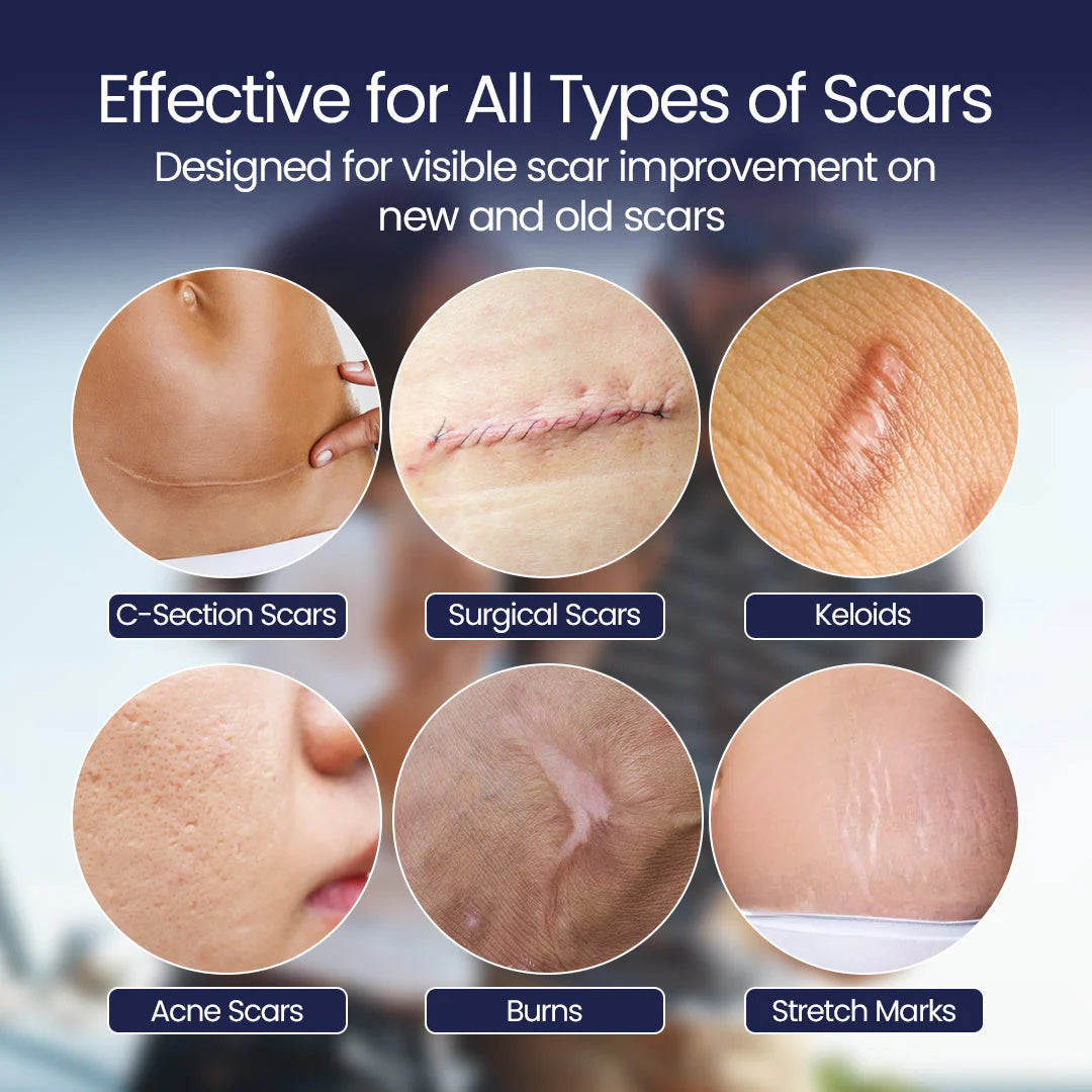 ScarFix+ Medical Transparent Silicone Plasters