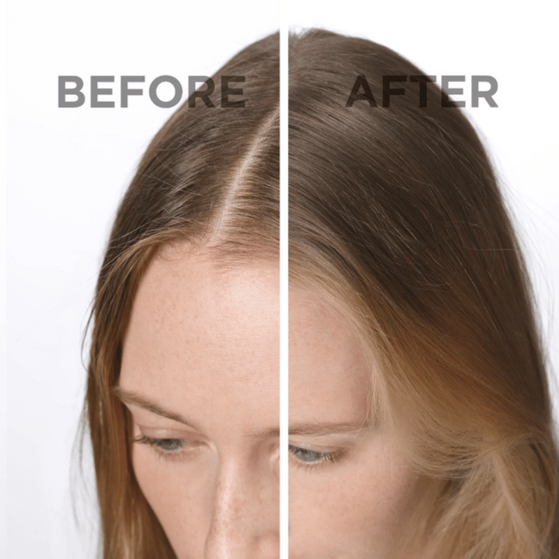 Phyto SOFTNESS Dry Shampoo 75ml