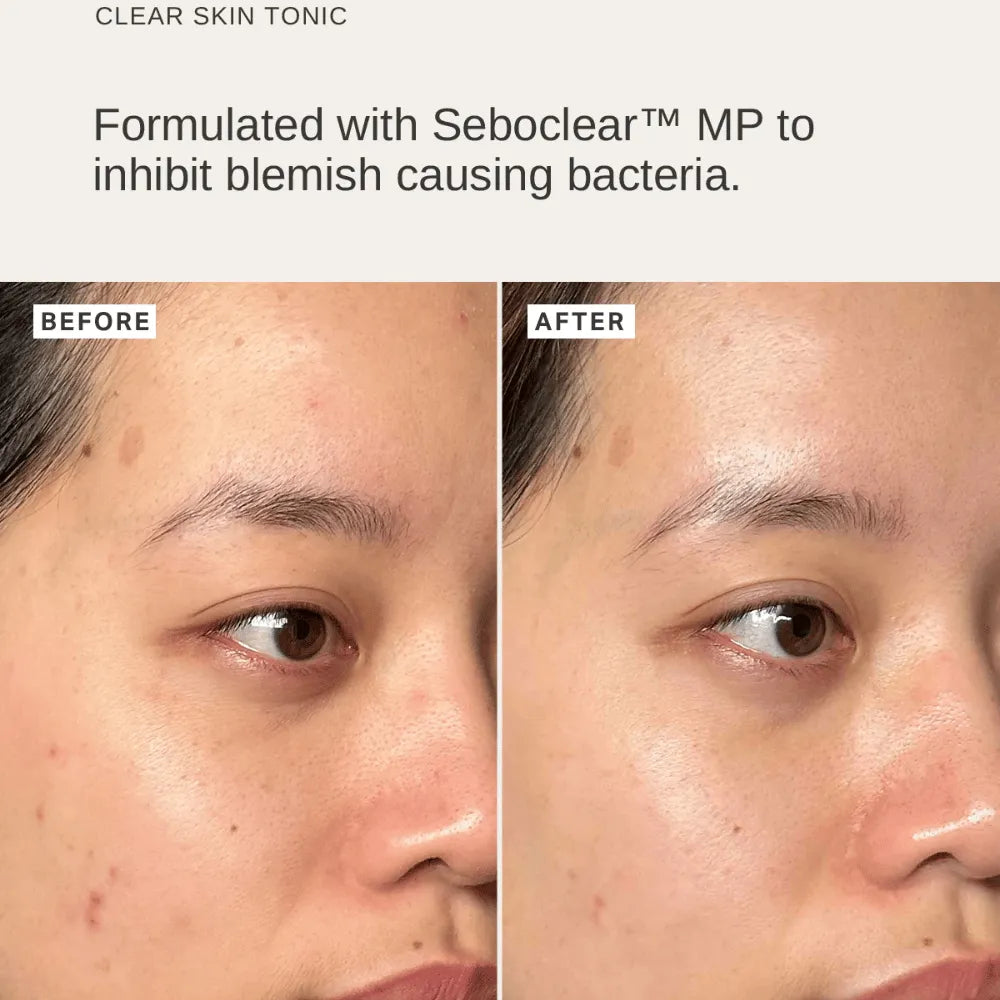 Alpha-H Blemish Duo