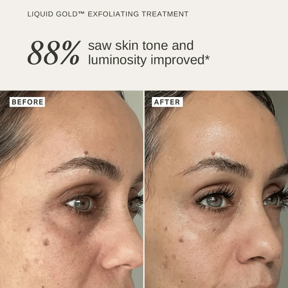 Alpha-H Cleanse & Exfoliate Duo