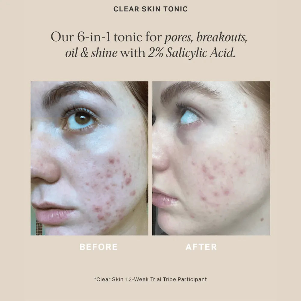 Alpha-H Clear Skin Tonic 30ml