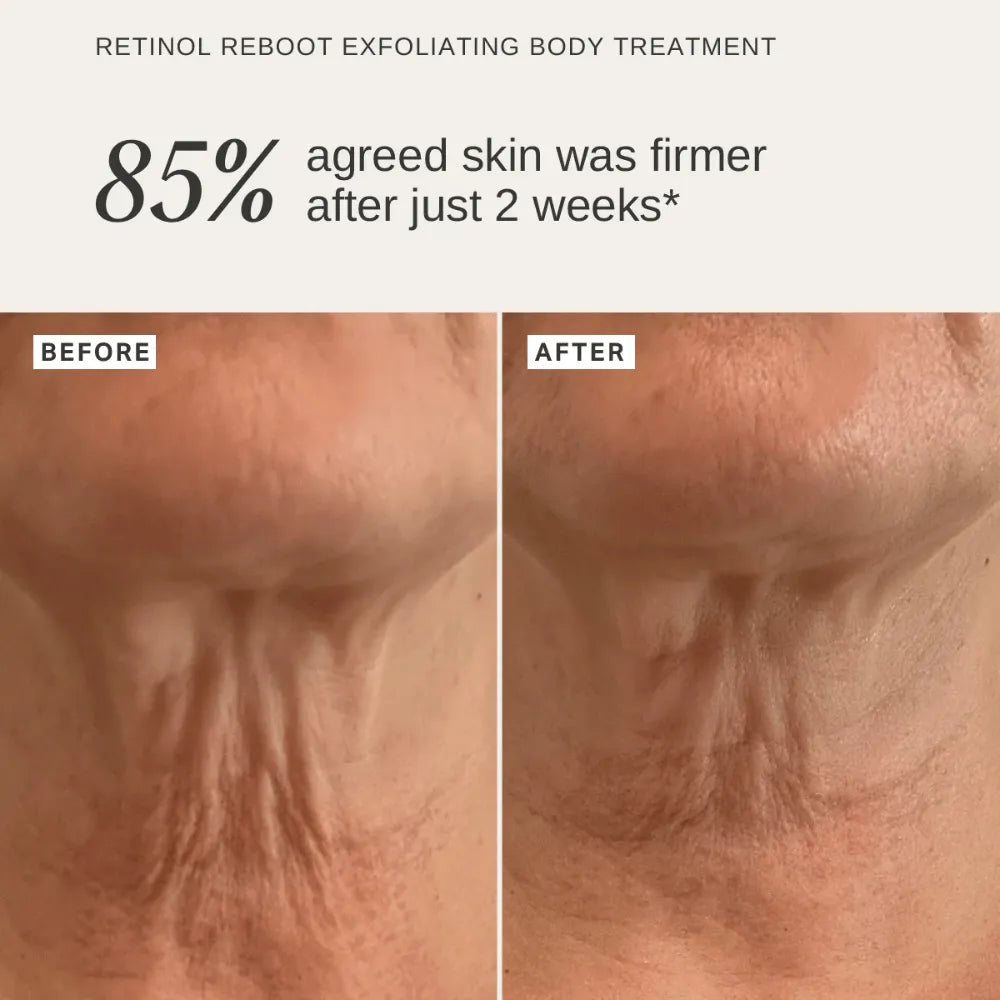 Alpha-H Scalp & Body Trio