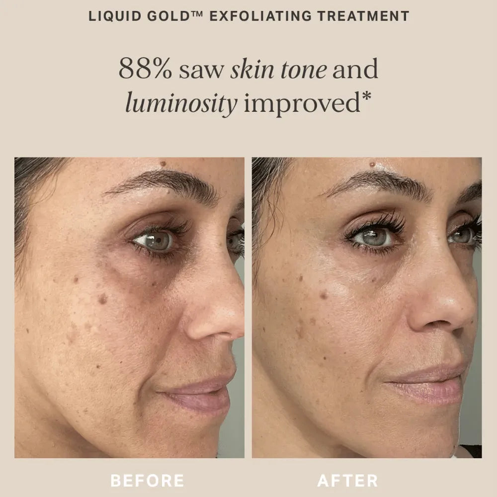 Alpha-H Liquid Gold with 5% Glycolic Acid 200ml