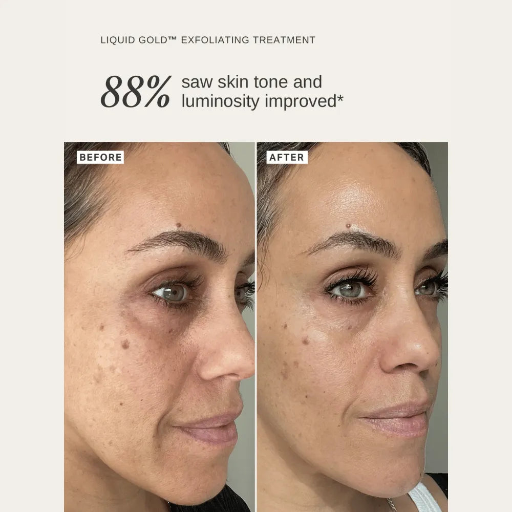 Alpha-H Liquid Gold 30ml