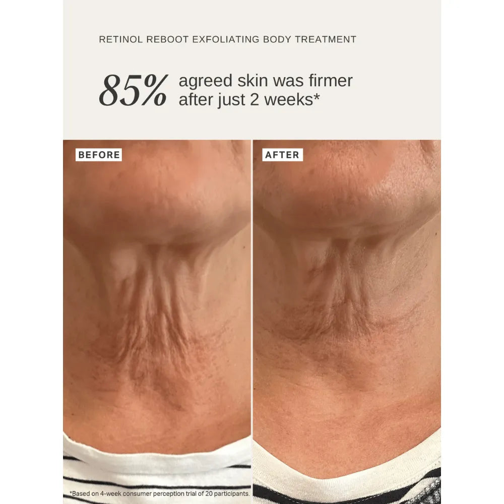 Alpha-H Retinol Reboot Exfoliating Body Treatment 120ml