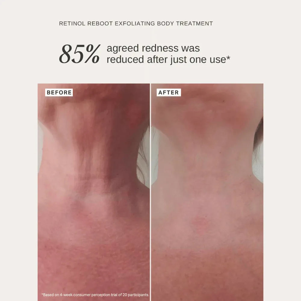 Alpha-H Retinol Reboot Exfoliating Body Treatment 120ml