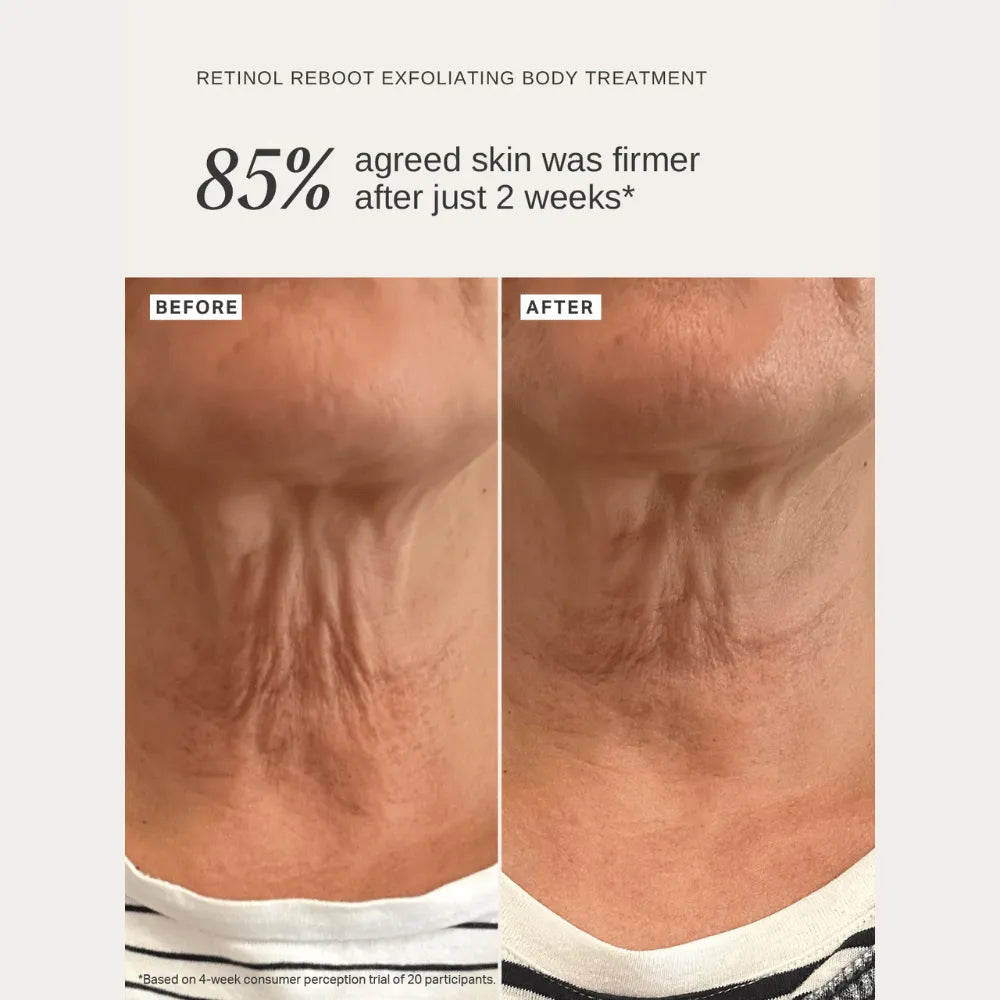 Alpha-H Retinol Reboot Exfoliating Body Treatment 120ml