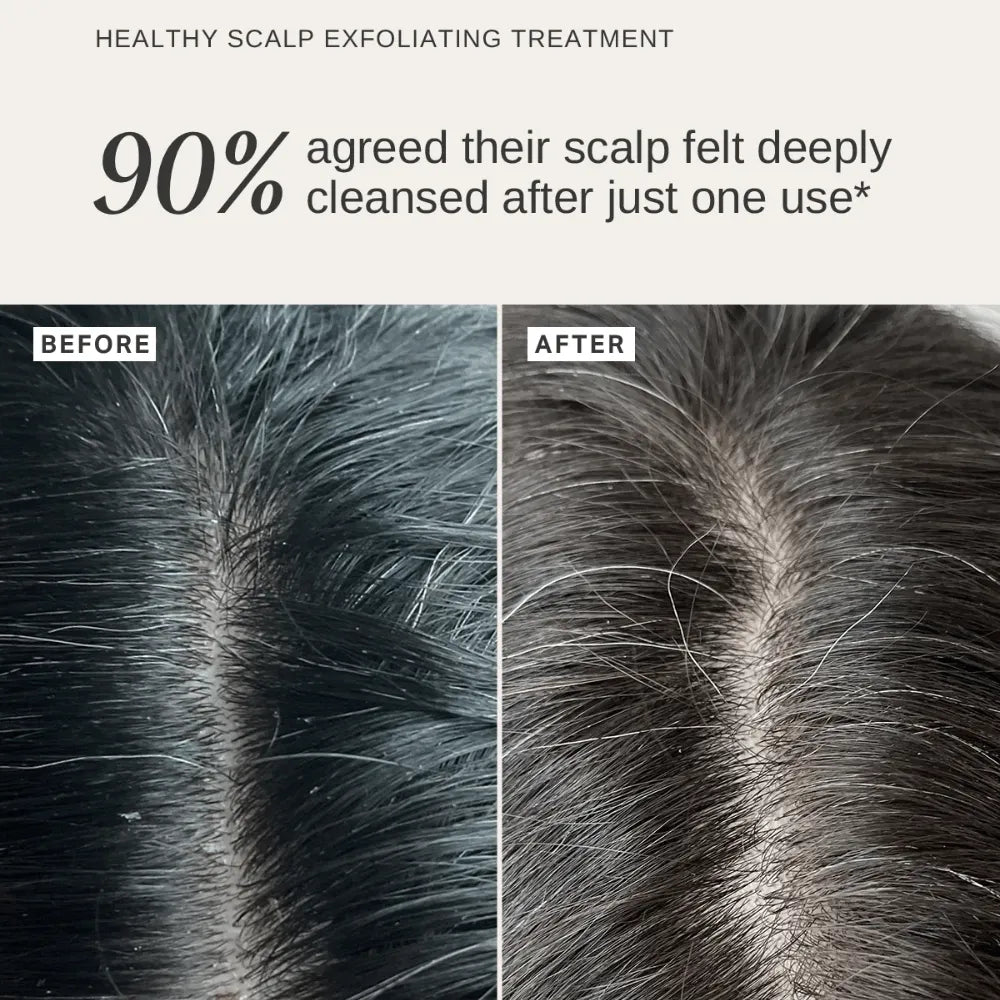 Alpha-H Scalp & Body Trio