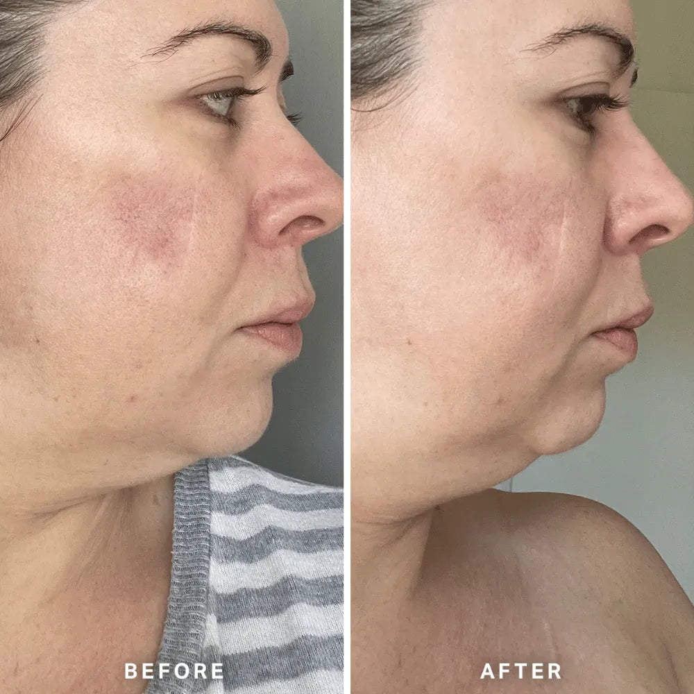 Alpha-H Vitamin A Serum 10ml