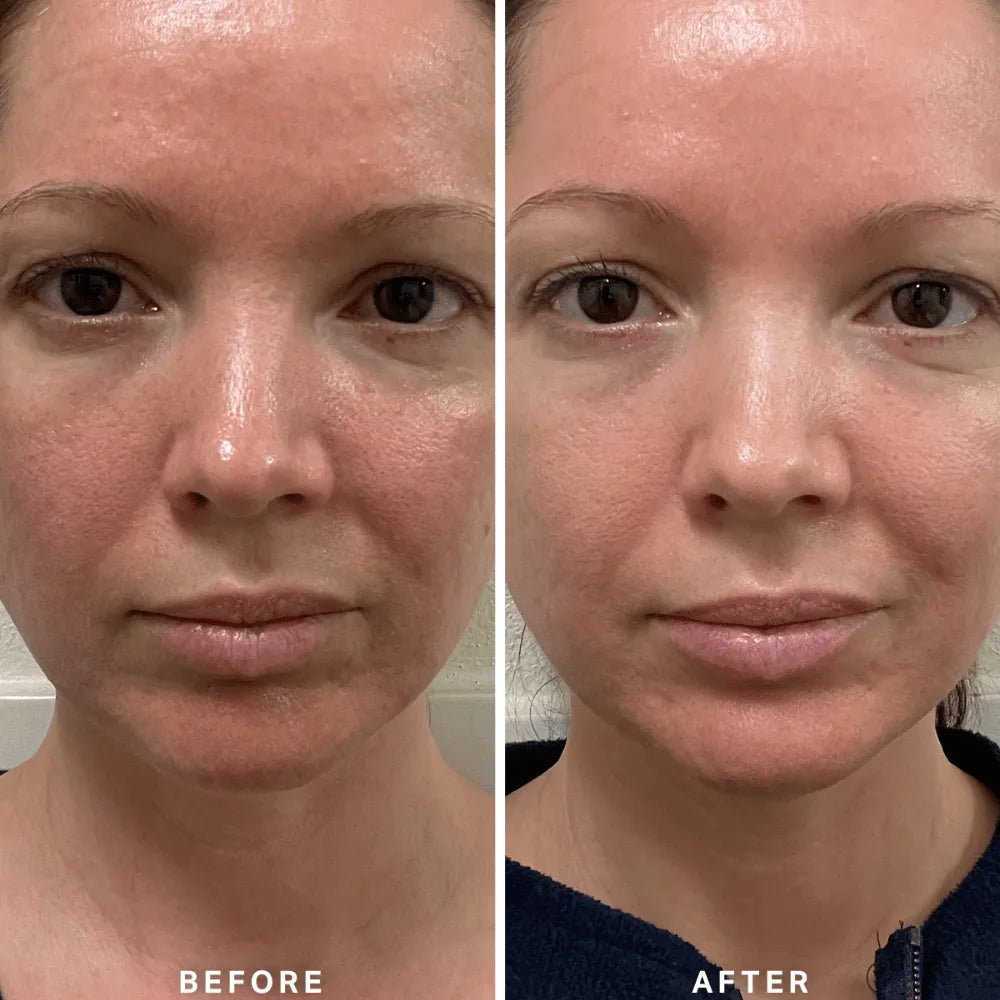 Alpha-H Vitamin B Serum with 5% Niacinamide 10ml