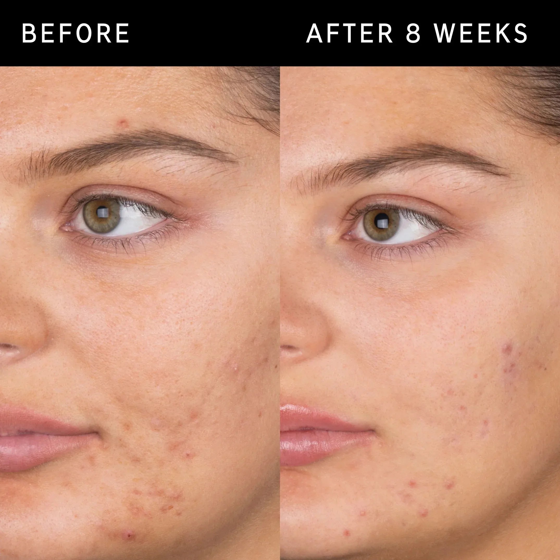 The Inkey List Salicylic Acid Cleanser - 150ml