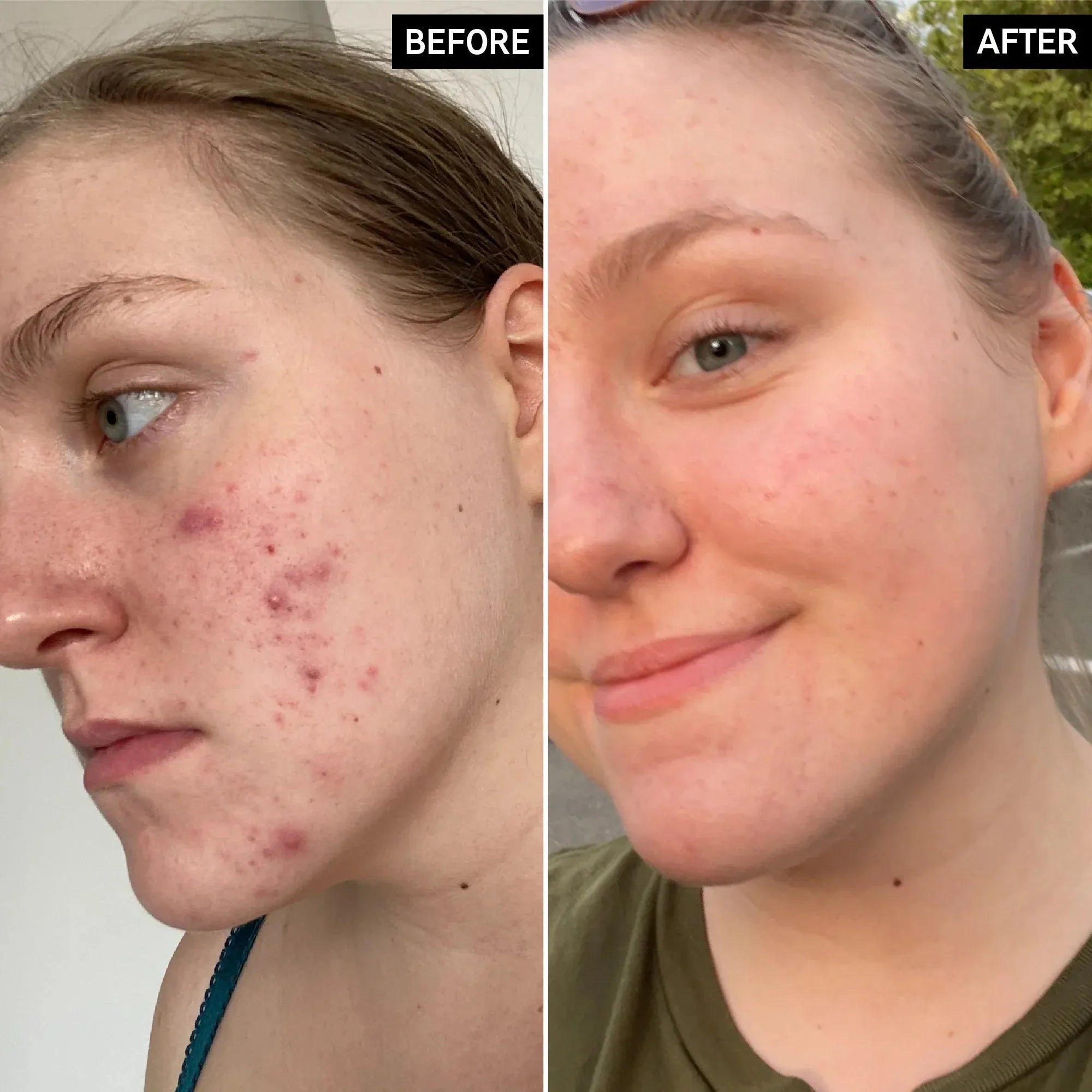 The Inkey List Glycolic Acid Toner - 100ml