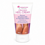Carnation Cracked Heel Cream - 50ml