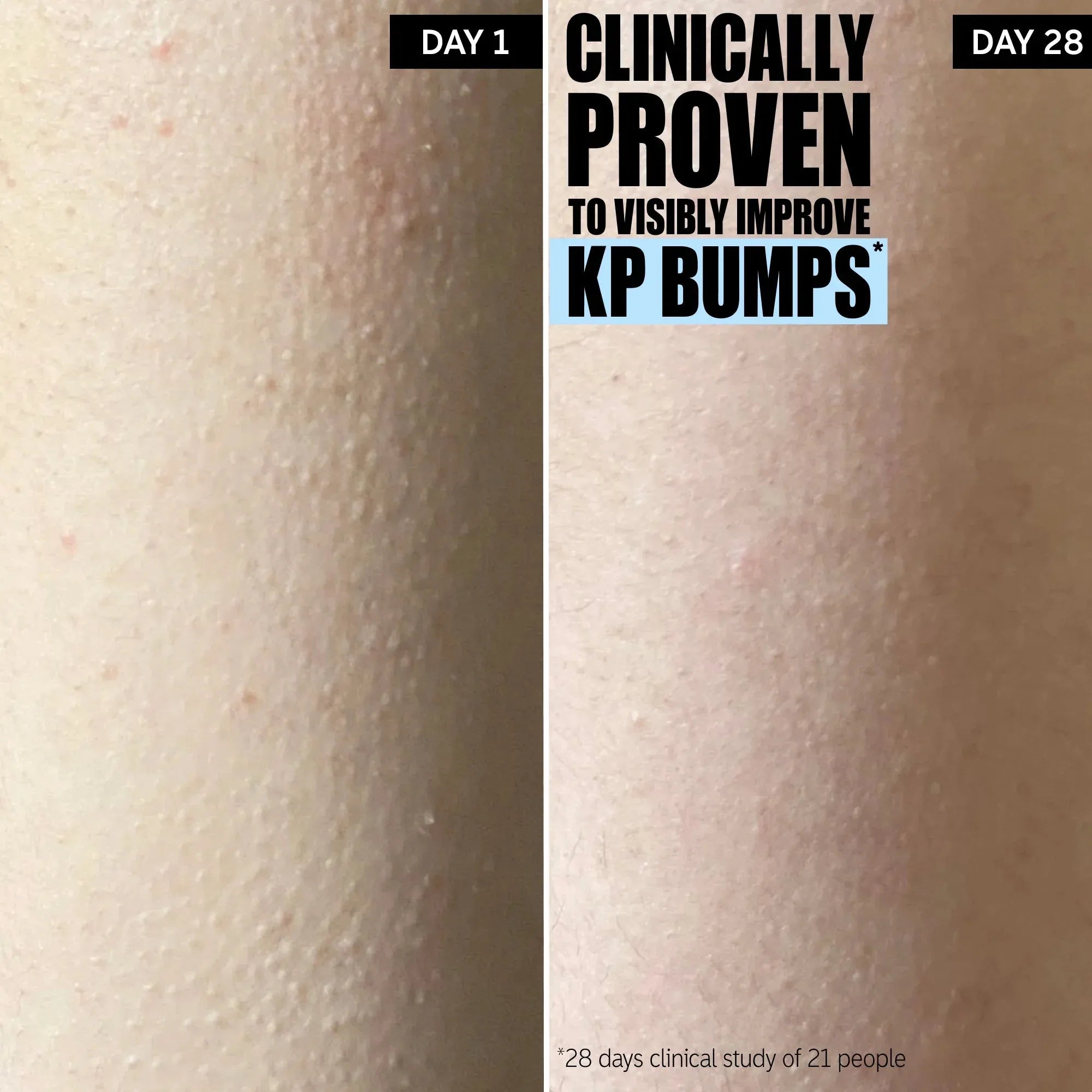 The Inkey List Glycolic Acid Exfoliating Body Stick -45g