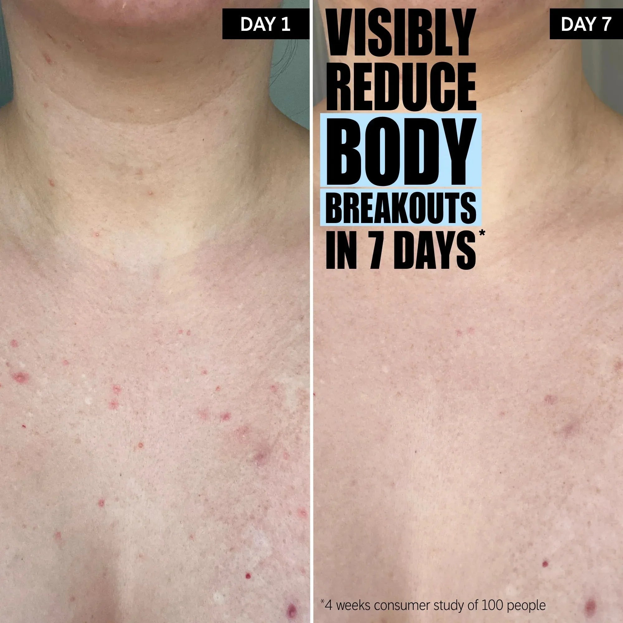 The Inkey List Glycolic Acid Exfoliating Body Stick -45g