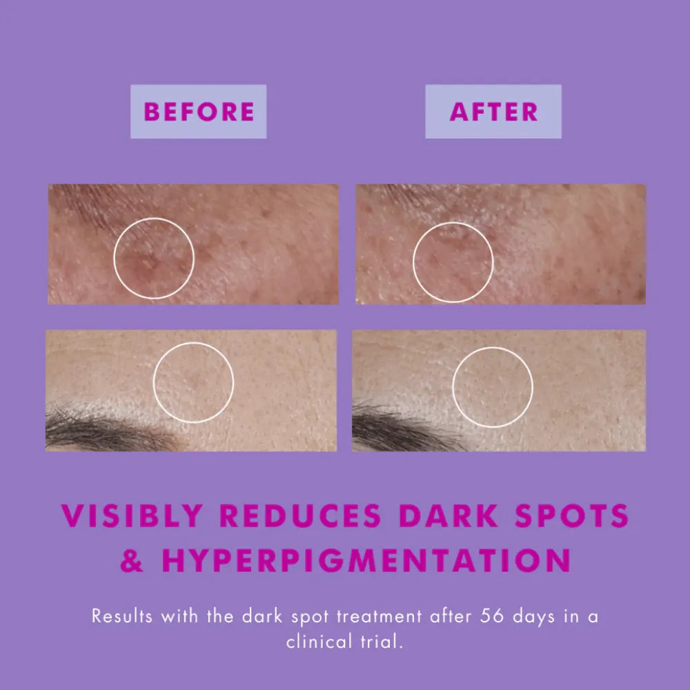 Hello Sunday The One That Makes You glow (Dark Spot Serum) - 30ml