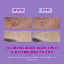 Hello Sunday The One That Makes You glow (Dark Spot Serum) - 30ml