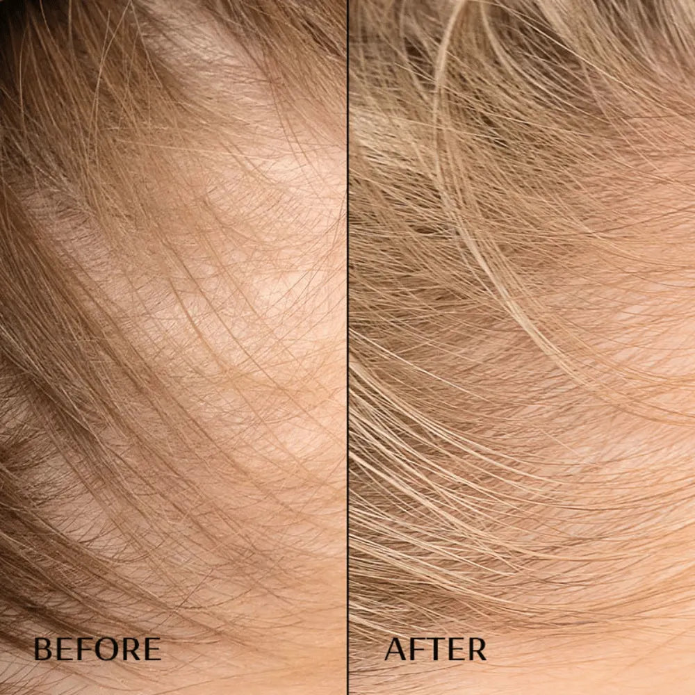 M2 BEAUTÉ Hair Activating Serum 30ml