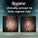 Regaine (minoxidil) 5% Foam For Men - 9 Month Supply