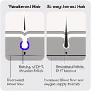 Sons Complete Hair Loss Treatment. Minoxidil 5%-3 Month Supply