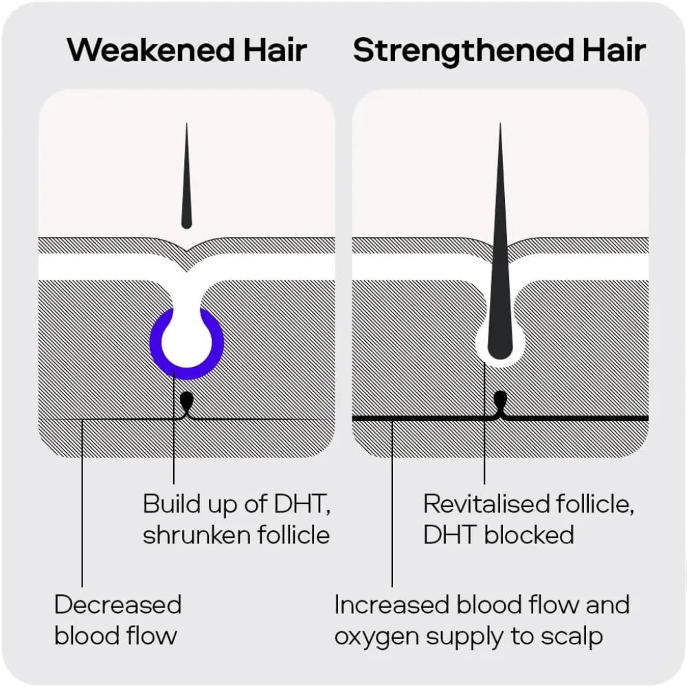 Sons Hair Growth Shampoo For Men- 3 Month Supply