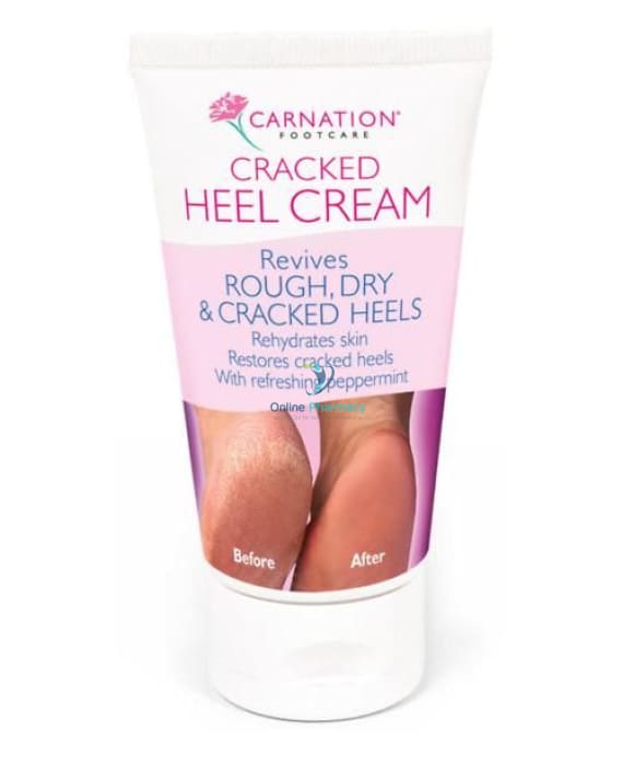 Carnation Cracked Heel Cream - 50ml - OnlinePharmacy