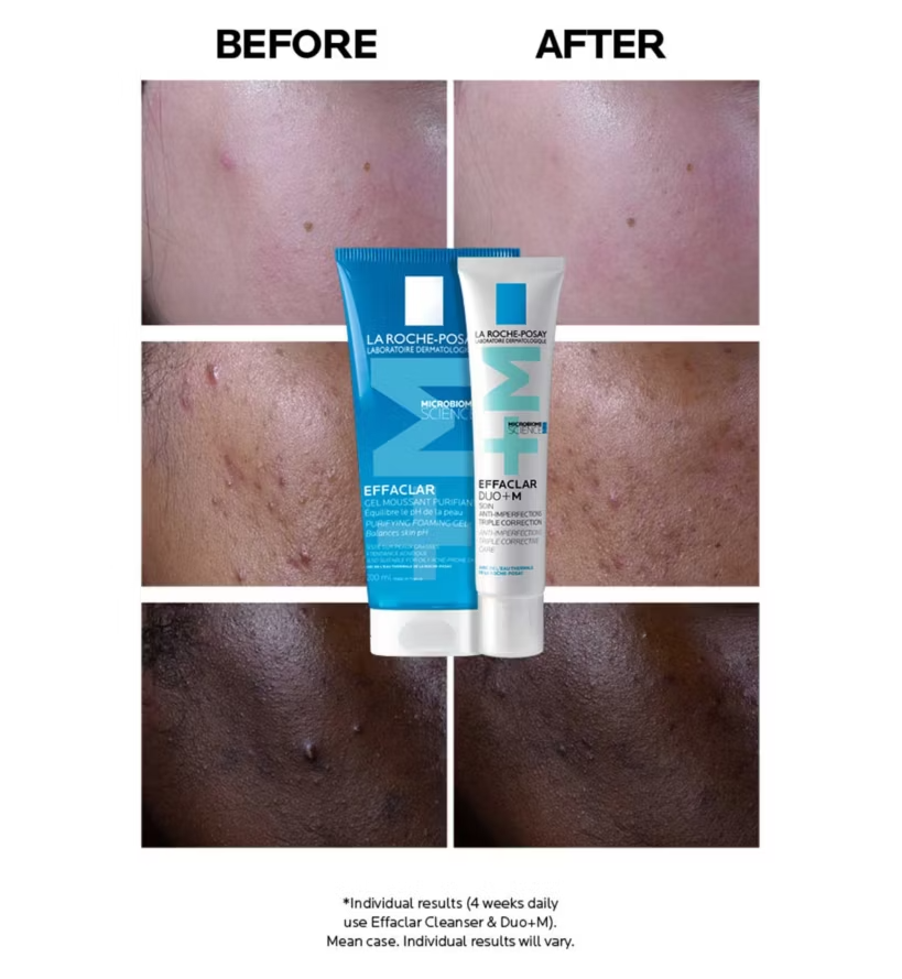 La Roche Posay Effaclar Duo + M 40ml