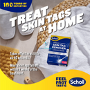 Scholl Freeze Away Skin Tag Remover